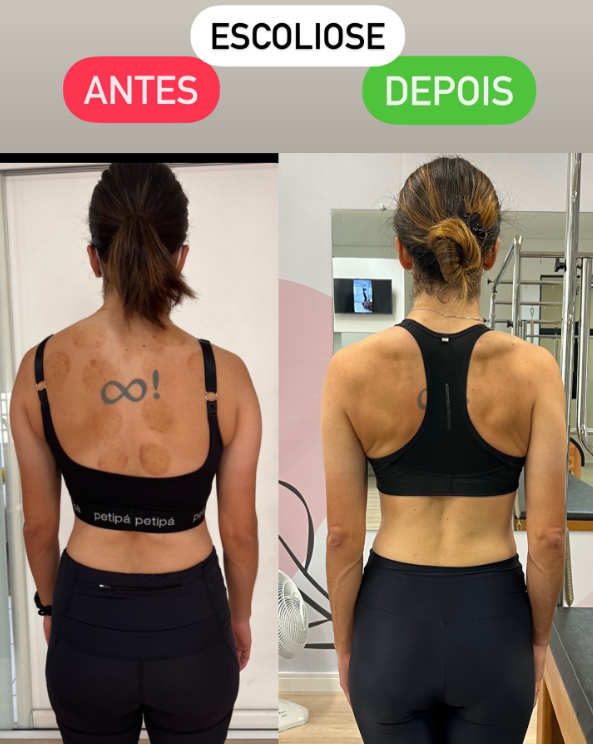 Depoimento Renata Ferreira